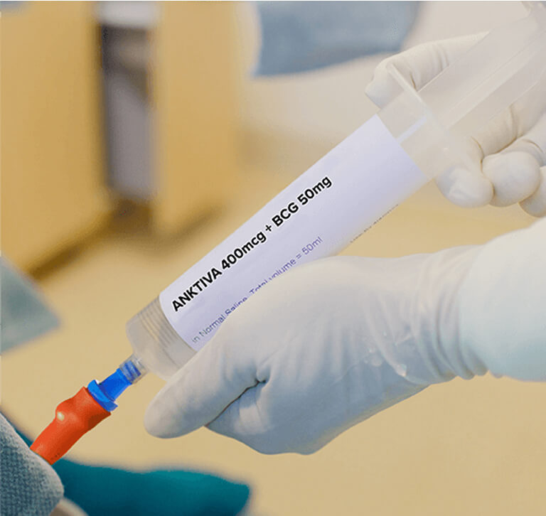 Medical professional in gloves preparing ANKTIVA (nogapendekin alfa inbakicept) + BCG 50mg suspension for intravesical instillation: close-up of a pre-filled syringe labeled "ANKTIVA 400mcg + BCG 50mg in Normal Saline Total volume = 50ml" being connected to a blue-tipped catheter