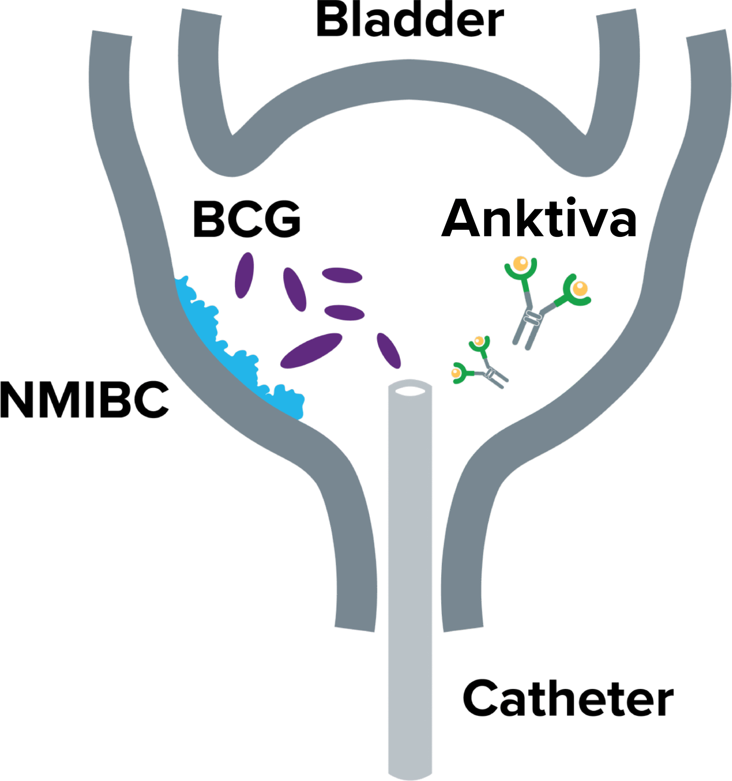 nmibc-graphic